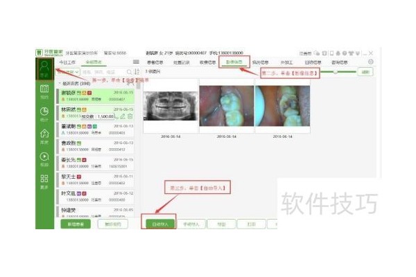 口腔管理软件影像自动导入操作方法