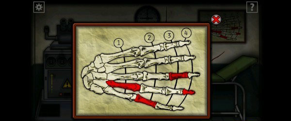 遗忘之丘手术室中文版 遗忘之丘手术室中文版