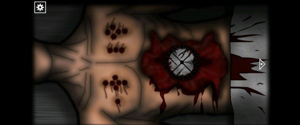 遗忘之丘手术室中文版 遗忘之丘手术室中文版