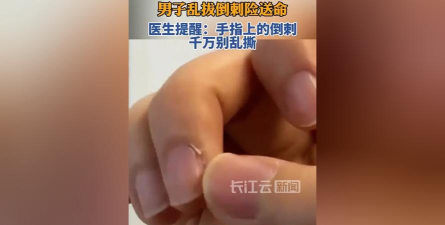 撕倒刺手游 撕倒刺手游