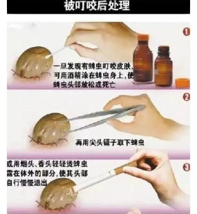 REPO蜱虫怎么打?高效实用的REPO蜱虫清除与防治方法分享 REPO蜱虫怎么打?高效实用的REPO蜱虫清除与防治方法分享