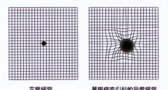 异环异视投影是什么? 异环异视投影是什么?