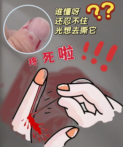 撕倒刺手游 撕倒刺手游