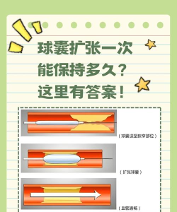 怎么做扩张,常见误区,实用建议 怎么做扩张,常见误区,实用建议