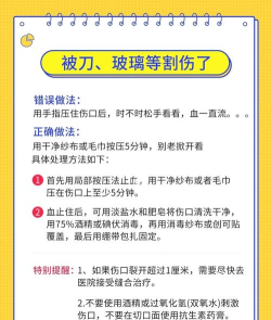 如何拿刀,安全操作,避免意外伤害 如何拿刀,安全操作,避免意外伤害