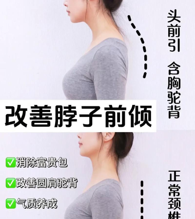 抬头怎么练,改善脖子前倾,提升体态气质 抬头怎么练,改善脖子前倾,提升体态气质