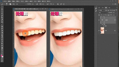 怎么p牙齿,修图技巧分享,效果自然真实 怎么p牙齿,修图技巧分享,效果自然真实