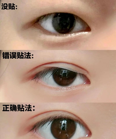 怎么p双眼皮 怎么p双眼皮