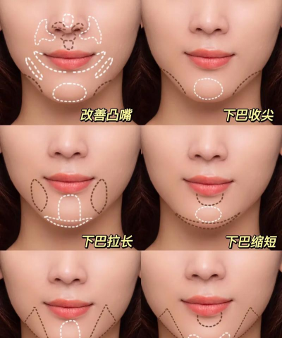 ps双下巴如何修掉,掌握关键步骤,轻松美化人像 ps双下巴如何修掉,掌握关键步骤,轻松美化人像