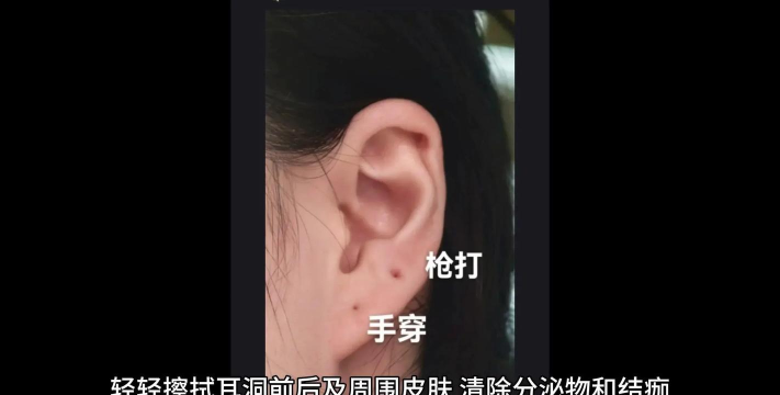 耳塞怎么清洗,保持清洁卫生,延长使用寿命 耳塞怎么清洗,保持清洁卫生,延长使用寿命