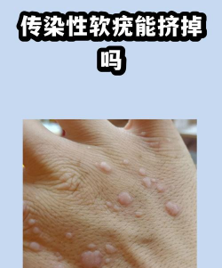 怎么下载皮肤,获取安全来源,避免安装风险 怎么下载皮肤,获取安全来源,避免安装风险