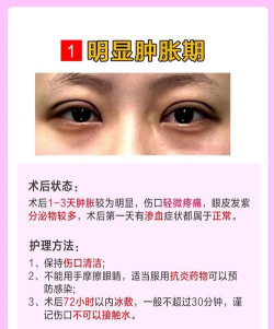 怎么p双眼皮 怎么p双眼皮